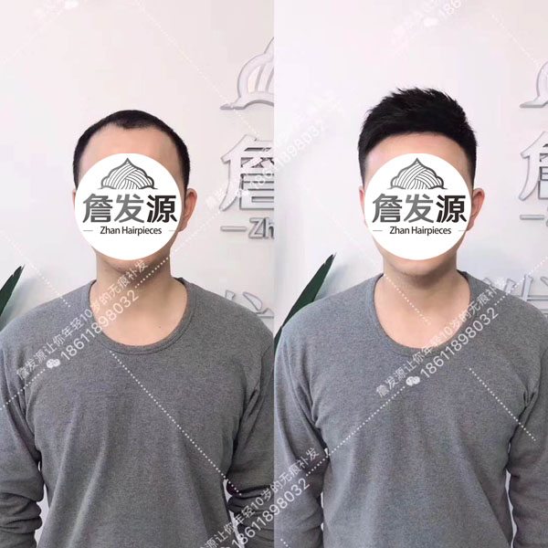 长沙IT技术总监打飞的来詹发源补发，有头发更帅