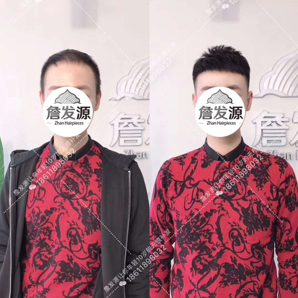沈阳30岁小伙在詹发源补发后更加帅气了！