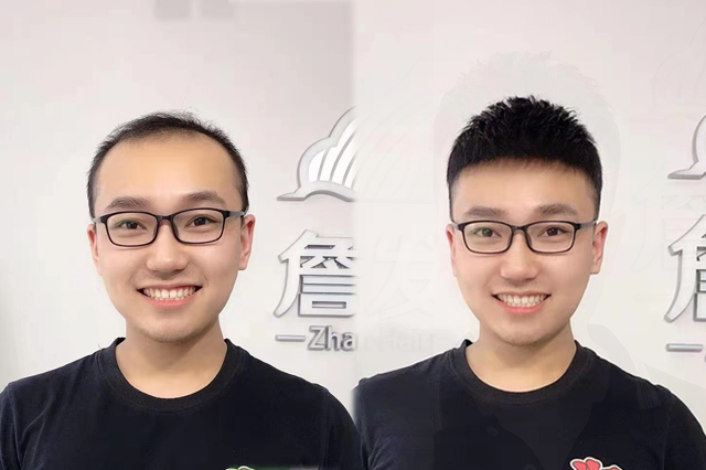 杭州假发定制哪家最好