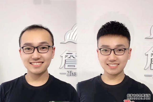 深圳假发定制实体店哪家好